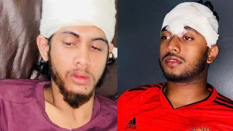 সুনামগঞ্জে গভীর রাতে বৈষম্যবিরোধীর দুই কর্মীকে কোপাল ছাত্রলীগ